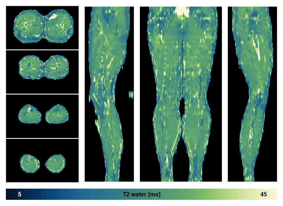 The water only T2 relaxation time of the lower extremity obtained from multi echo spin echo t2 mapping with EPG based reconstruction.